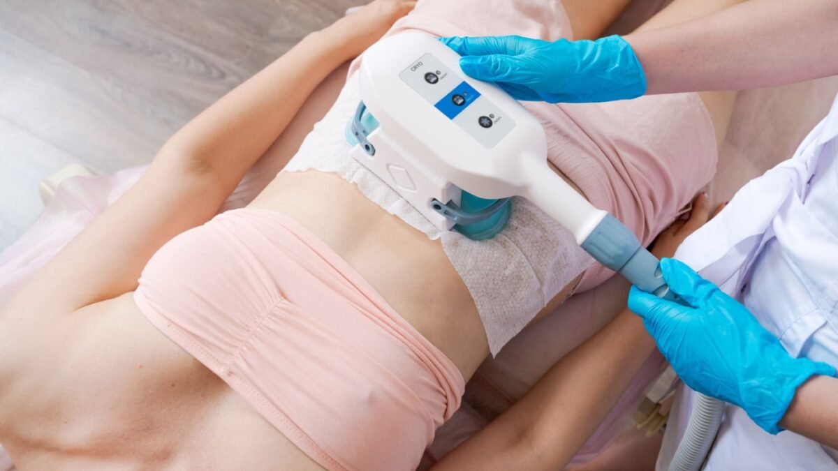 What Are the Benefits of Coolsculpting?